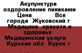 Акупунктура, оздоровление пиявками › Цена ­ 3 000 - Все города, Жуковский г. Медицина, красота и здоровье » Медицинские услуги   . Курская обл.,Курск г.